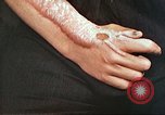 Image of medical care for atomic bomb victim Hiroshima Japan, 1946, second 37 stock footage video 65675060690