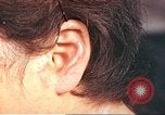 Image of medical care for atomic bomb victim Hiroshima Japan, 1946, second 43 stock footage video 65675060690