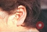 Image of medical care for atomic bomb victim Hiroshima Japan, 1946, second 44 stock footage video 65675060690