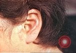 Image of medical care for atomic bomb victim Hiroshima Japan, 1946, second 46 stock footage video 65675060690