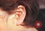 Image of medical care for atomic bomb victim Hiroshima Japan, 1946, second 47 stock footage video 65675060690