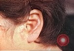 Image of medical care for atomic bomb victim Hiroshima Japan, 1946, second 48 stock footage video 65675060690