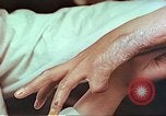Image coude et part ses blessures de bombe atomique Hiroshima au Japon, 1946, de la seconde 22 séquences d'archives historiques vidéo 65675060691
