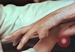 Image coude et part ses blessures de bombe atomique Hiroshima au Japon, 1946, de la seconde 23 séquences d'archives historiques vidéo 65675060691