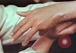Image coude et part ses blessures de bombe atomique Hiroshima au Japon, 1946, de la seconde 31 séquences d'archives historiques vidéo 65675060691