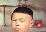 Image of Japanese atomic bomb victim wounds Hiroshima Japan, 1946, second 20 stock footage video 65675060694