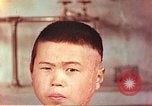 Image of Japanese atomic bomb victim wounds Hiroshima Japan, 1946, second 21 stock footage video 65675060694