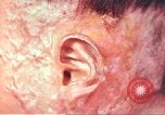Image of Japanese atomic bomb victim wounds Hiroshima Japan, 1946, second 23 stock footage video 65675060694