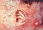 Image of Japanese atomic bomb victim wounds Hiroshima Japan, 1946, second 24 stock footage video 65675060694