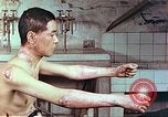 Image of wounds on bicyclist from atomic bomb blast Hiroshima Japan, 1946, second 3 stock footage video 65675060695