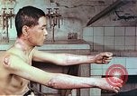 Image of wounds on bicyclist from atomic bomb blast Hiroshima Japan, 1946, second 5 stock footage video 65675060695