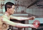 Image of wounds on bicyclist from atomic bomb blast Hiroshima Japan, 1946, second 6 stock footage video 65675060695