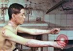 Image of wounds on bicyclist from atomic bomb blast Hiroshima Japan, 1946, second 8 stock footage video 65675060695