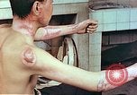 Image of wounds on bicyclist from atomic bomb blast Hiroshima Japan, 1946, second 9 stock footage video 65675060695