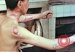Image of wounds on bicyclist from atomic bomb blast Hiroshima Japan, 1946, second 10 stock footage video 65675060695