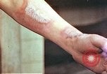 Image of wounds on bicyclist from atomic bomb blast Hiroshima Japan, 1946, second 16 stock footage video 65675060695