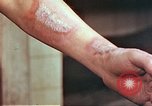 Image of wounds on bicyclist from atomic bomb blast Hiroshima Japan, 1946, second 18 stock footage video 65675060695