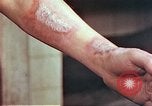 Image of wounds on bicyclist from atomic bomb blast Hiroshima Japan, 1946, second 19 stock footage video 65675060695
