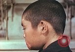 Image of clothing lines on atomic bomb burn victim Hiroshima Japan, 1946, second 4 stock footage video 65675060696