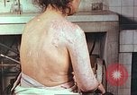 Image effets de position sur victime de la bombe atomique Hiroshima au Japon, 1946, de la seconde 3 séquences d'archives historiques vidéo 65675060697
