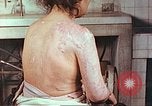 Image effets de position sur victime de la bombe atomique Hiroshima au Japon, 1946, de la seconde 7 séquences d'archives historiques vidéo 65675060697