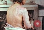 Image effets de position sur victime de la bombe atomique Hiroshima au Japon, 1946, de la seconde 8 séquences d'archives historiques vidéo 65675060697