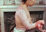 Image effets de position sur victime de la bombe atomique Hiroshima au Japon, 1946, de la seconde 9 séquences d'archives historiques vidéo 65675060697