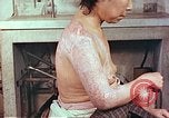 Image effets de position sur victime de la bombe atomique Hiroshima au Japon, 1946, de la seconde 12 séquences d'archives historiques vidéo 65675060697