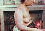 Image effets de position sur victime de la bombe atomique Hiroshima au Japon, 1946, de la seconde 14 séquences d'archives historiques vidéo 65675060697