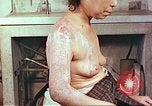 Image effets de position sur victime de la bombe atomique Hiroshima au Japon, 1946, de la seconde 18 séquences d'archives historiques vidéo 65675060697