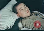 Image of Japanese patient Nagasaki Japan, 1946, second 4 stock footage video 65675060752