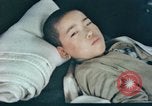 Image of Japanese patient Nagasaki Japan, 1946, second 5 stock footage video 65675060752