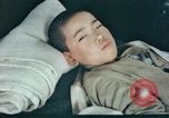 Image of Japanese patient Nagasaki Japan, 1946, second 6 stock footage video 65675060752