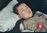 Image of Japanese patient Nagasaki Japan, 1946, second 8 stock footage video 65675060752
