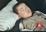 Image of Japanese patient Nagasaki Japan, 1946, second 11 stock footage video 65675060752