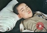 Image of Japanese patient Nagasaki Japan, 1946, second 12 stock footage video 65675060752