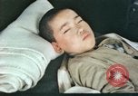 Image of Japanese patient Nagasaki Japan, 1946, second 13 stock footage video 65675060752