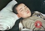 Image of Japanese patient Nagasaki Japan, 1946, second 16 stock footage video 65675060752