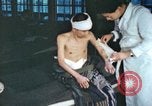 Image of Japanese patient Nagasaki Japan, 1946, second 23 stock footage video 65675060752