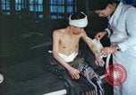 Image of Japanese patient Nagasaki Japan, 1946, second 24 stock footage video 65675060752