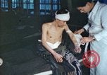 Image of Japanese patient Nagasaki Japan, 1946, second 25 stock footage video 65675060752