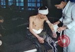 Image of Japanese patient Nagasaki Japan, 1946, second 26 stock footage video 65675060752