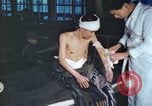 Image of Japanese patient Nagasaki Japan, 1946, second 27 stock footage video 65675060752