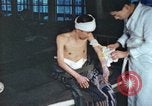 Image of Japanese patient Nagasaki Japan, 1946, second 28 stock footage video 65675060752