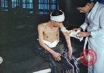 Image of Japanese patient Nagasaki Japan, 1946, second 29 stock footage video 65675060752