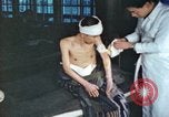 Image of Japanese patient Nagasaki Japan, 1946, second 30 stock footage video 65675060752