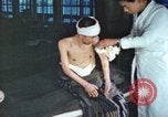 Image of Japanese patient Nagasaki Japan, 1946, second 31 stock footage video 65675060752