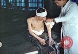 Image of Japanese patient Nagasaki Japan, 1946, second 32 stock footage video 65675060752