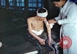 Image of Japanese patient Nagasaki Japan, 1946, second 33 stock footage video 65675060752