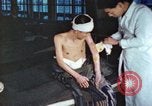 Image of Japanese patient Nagasaki Japan, 1946, second 36 stock footage video 65675060752